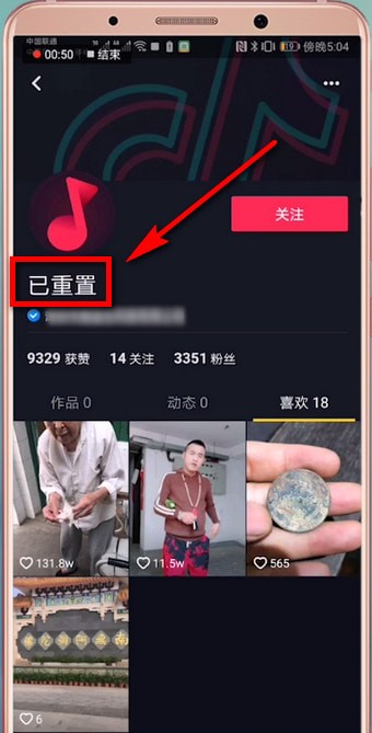 抖音APP怎么恢复重置视频？恢复重置视频的方法介绍                             